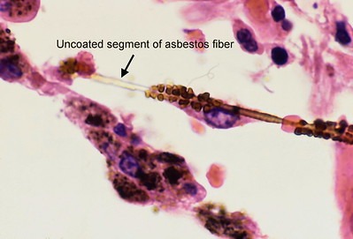 41141214935 a7e61ae91b w